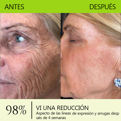 🎖️🎖️🎖️ Hecho y enviado desde México 💫 Healrize® Botox & Vita-A Retinol Shot Crema Lifting Reafirmante Antiarrugas 🔥 ¡Último día de promoción — 70% DE DESCUENTO! 🇲🇽