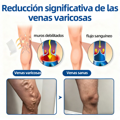 🇲🇽👨‍⚕️👍✅Healrize® Parche Microneedle VeinTarget🎖️Alivio Instantáneo, Resultados a Largo Plazo 🎖️