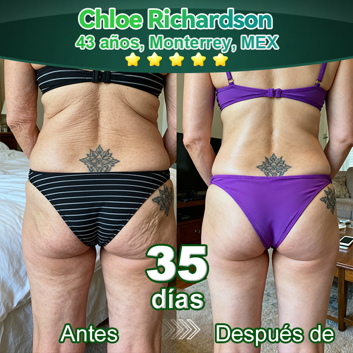 𝐀w𝐳l𝐨v𝐞® A𝐜e𝐢t𝐞 𝐀n𝐭i𝐜e𝐥u𝐥í𝐭i𝐜o d𝐞 𝐋u𝐣o c𝐨n C𝐨l𝐚́g𝐞n𝐨 𝐲 𝐂é𝐥u𝐥a𝐬 𝐌a𝐝r𝐞🐳 (🔥8𝟎% d𝐞 𝐝e𝐬c𝐮e𝐧t𝐨 𝐩o𝐫 𝐭i𝐞m𝐩o l𝐢m𝐢t𝐚d𝐨!)