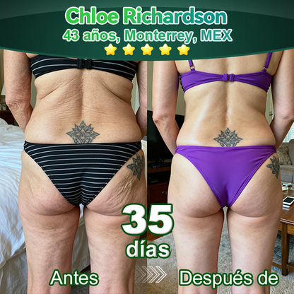 𝐀w𝐳l𝐨v𝐞® A𝐜e𝐢t𝐞 𝐀n𝐭i𝐜e𝐥u𝐥í𝐭i𝐜o d𝐞 𝐋u𝐣o c𝐨n C𝐨l𝐚́g𝐞n𝐨 𝐲 𝐂é𝐥u𝐥a𝐬 𝐌a𝐝r𝐞🐳 (🔥8𝟎% d𝐞 𝐝e𝐬c𝐮e𝐧t𝐨 𝐩o𝐫 𝐭i𝐞m𝐩o l𝐢m𝐢t𝐚d𝐨!)