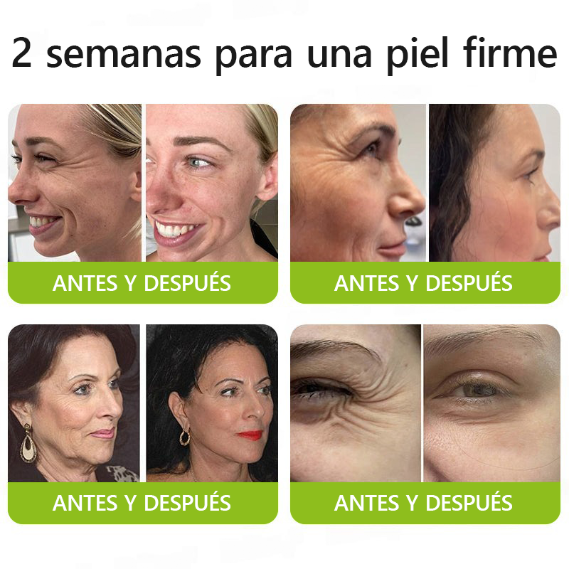 🎖️🎖️🎖️ Hecho y enviado desde México 💫 Healrize® Botox & Vita-A Retinol Shot Crema Lifting Reafirmante Antiarrugas 🔥 ¡Último día de promoción — 70% DE DESCUENTO! 🇲🇽