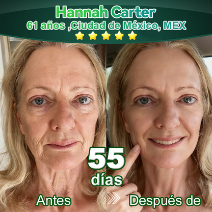 𝐀w𝐳l𝐨v𝐞® A𝐜e𝐢t𝐞 𝐀n𝐭i𝐜e𝐥u𝐥í𝐭i𝐜o d𝐞 𝐋u𝐣o c𝐨n C𝐨l𝐚́g𝐞n𝐨 𝐲 𝐂é𝐥u𝐥a𝐬 𝐌a𝐝r𝐞🐳 (🔥8𝟎% d𝐞 𝐝e𝐬c𝐮e𝐧t𝐨 𝐩o𝐫 𝐭i𝐞m𝐩o l𝐢m𝐢t𝐚d𝐨!)