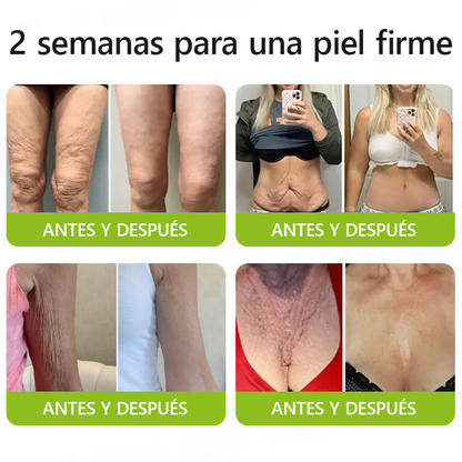 🎖️🎖️🎖️ Hecho y enviado desde México 💫 Healrize® Botox & Vita-A Retinol Shot Crema Lifting Reafirmante Antiarrugas 🔥 ¡Último día de promoción — 70% DE DESCUENTO! 🇲🇽