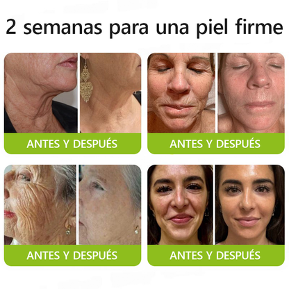 🎖️🎖️🎖️ Hecho y enviado desde México 💫 Healrize® Botox & Vita-A Retinol Shot Crema Lifting Reafirmante Antiarrugas 🔥 ¡Último día de promoción — 70% DE DESCUENTO! 🇲🇽
