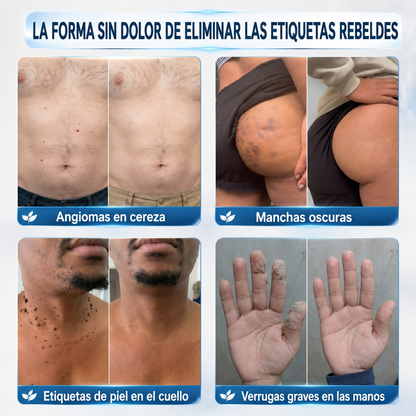 ¡Disfruta de un 30% de descuento al agregar el segundo! | 𝑯𝒆𝒂𝒍𝒓𝒊𝒛𝒆® 💚